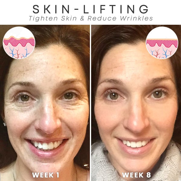 🔥BUY 2 GET 1 FREE-😍ANTI-AGING SERUM
