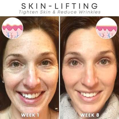 🔥BUY 2 GET 1 FREE-😍ANTI-AGING SERUM