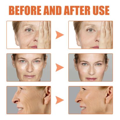 🔥BUY 2 GET 1 FREE-😍ANTI-AGING SERUM
