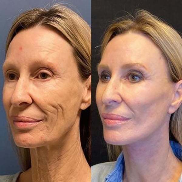 🔥BUY 2 GET 1 FREE-😍ANTI-AGING SERUM