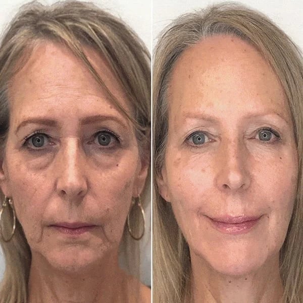 🔥BUY 2 GET 1 FREE-😍ANTI-AGING SERUM