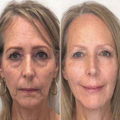 🔥BUY 2 GET 1 FREE-😍ANTI-AGING SERUM