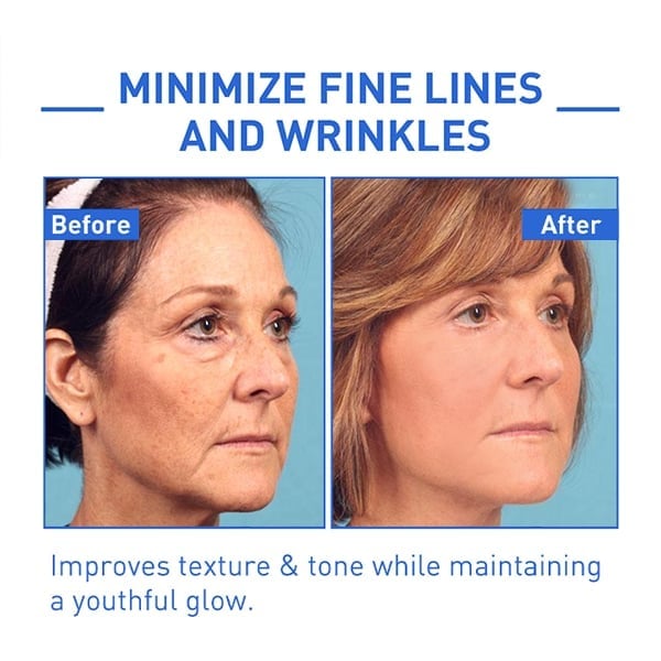 🔥BUY 2 GET 1 FREE-😍ANTI-AGING SERUM