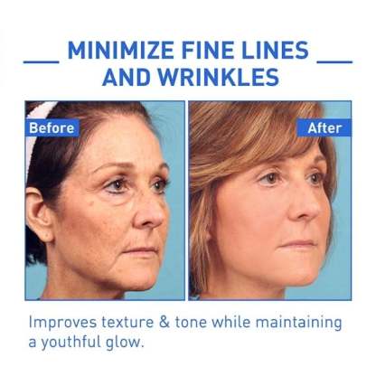 🔥BUY 2 GET 1 FREE-😍ANTI-AGING SERUM