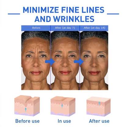 🔥BUY 2 GET 1 FREE-😍ANTI-AGING SERUM