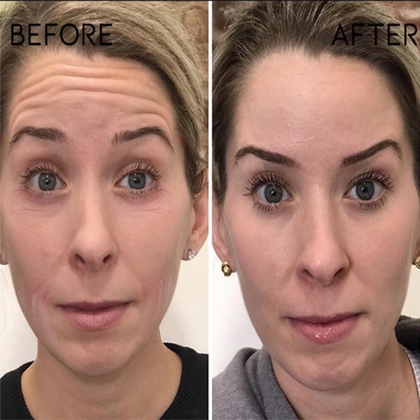 🔥BUY 2 GET 1 FREE-😍ANTI-AGING SERUM