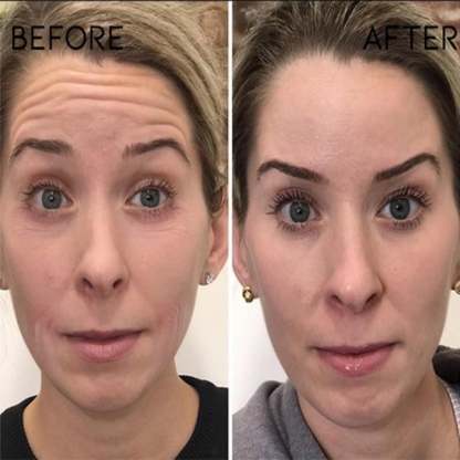 🔥BUY 2 GET 1 FREE-😍ANTI-AGING SERUM