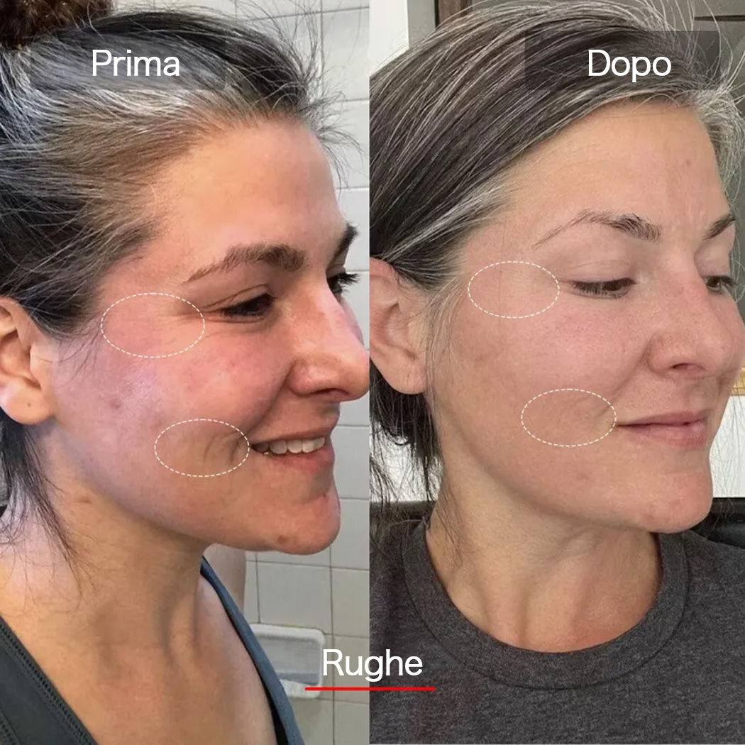 Veonskin Maschera LED Viso Pro - Terapia della Luce a 7 Colori per Cura della Pelle