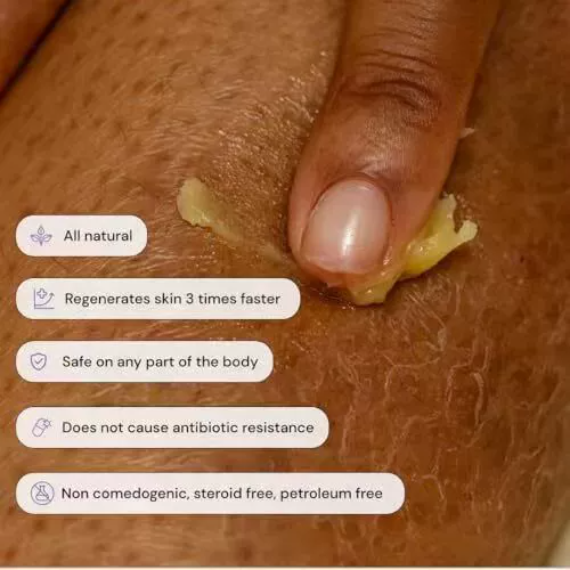 😍Handmade Thyme Tea Tree Skin Repair Cream