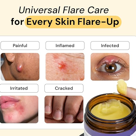 😍Handmade Thyme Tea Tree Skin Repair Cream