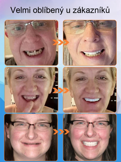 [Nový výzkum z Velké Británie] Silikonové zubní protézy