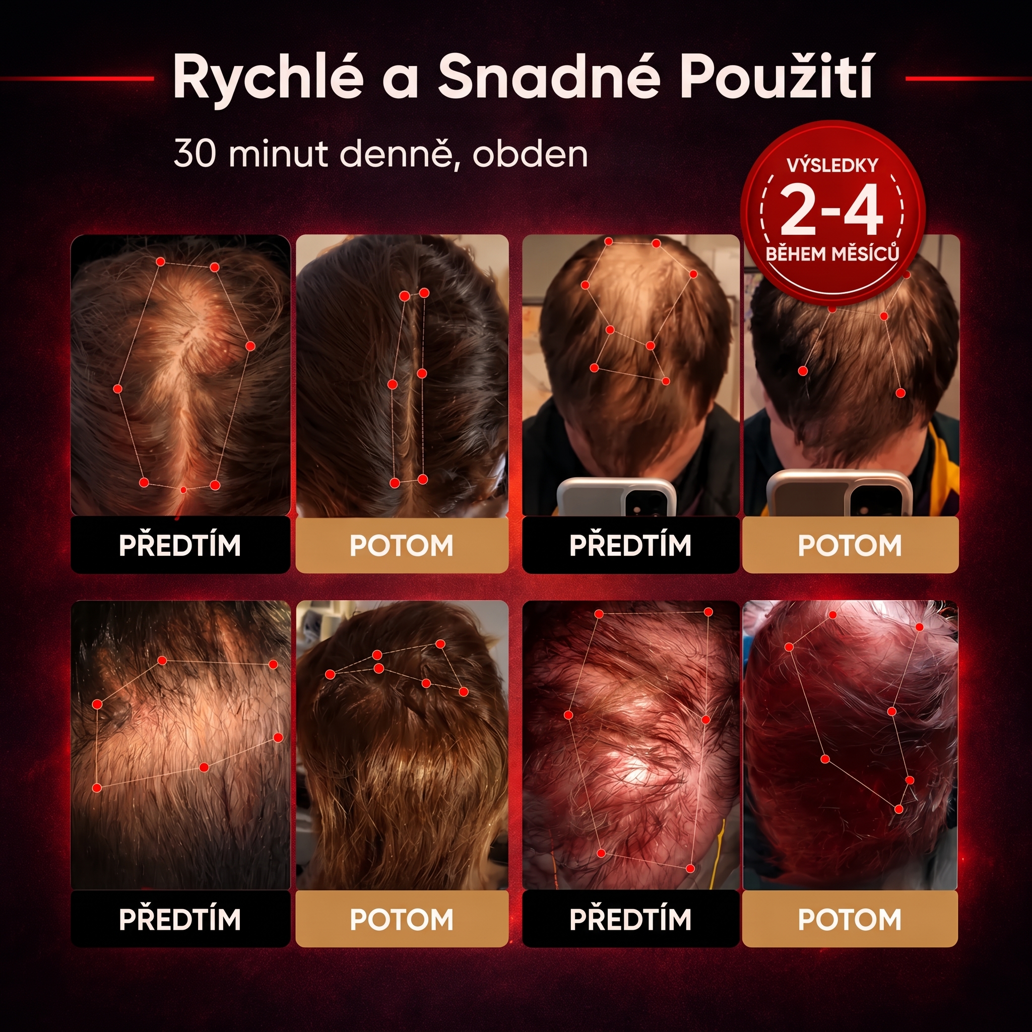 Spektromechanická čepice pro růst vlasů využívající červené světlo