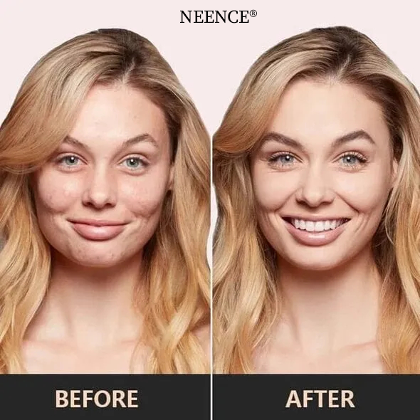 🎁BUY 1 GET 1 FREE⏰ - NEENCE® Mushroom Head Air Cushion CC Cream