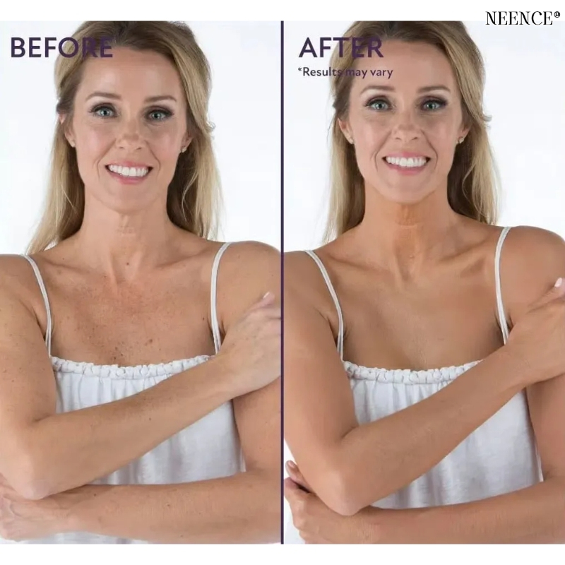 NEENCE®🔥BUY 1 GET 1 FREE🌟 NEENCE® Soft Matte Cream Concealer