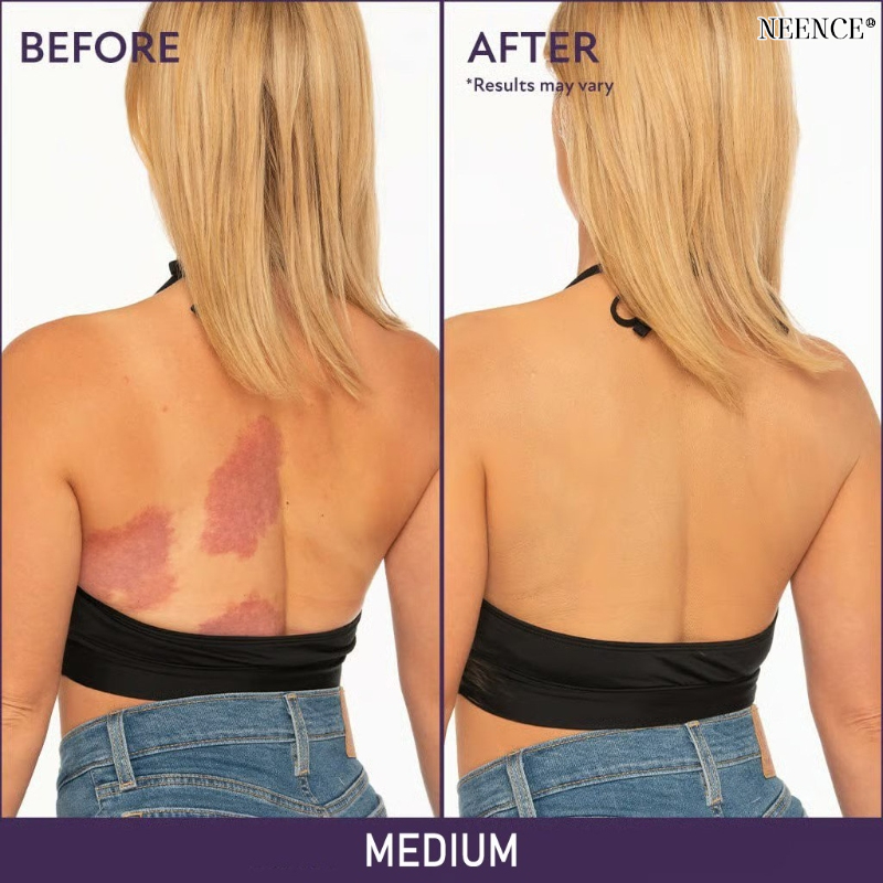 NEENCE®🔥BUY 1 GET 1 FREE🌟 NEENCE® Soft Matte Cream Concealer