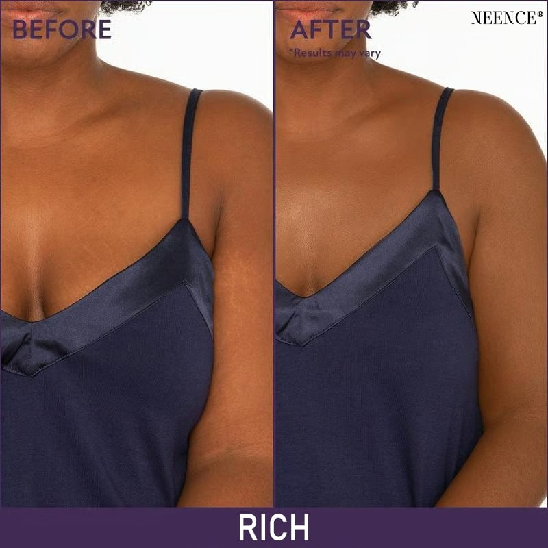 NEENCE®🔥BUY 1 GET 1 FREE🌟 NEENCE® Soft Matte Cream Concealer