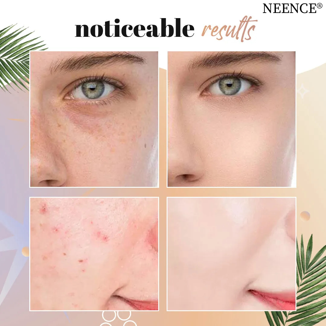 🎁BUY 1 GET 1 FREE⏰ - NEENCE® Mushroom Head Air Cushion CC Cream