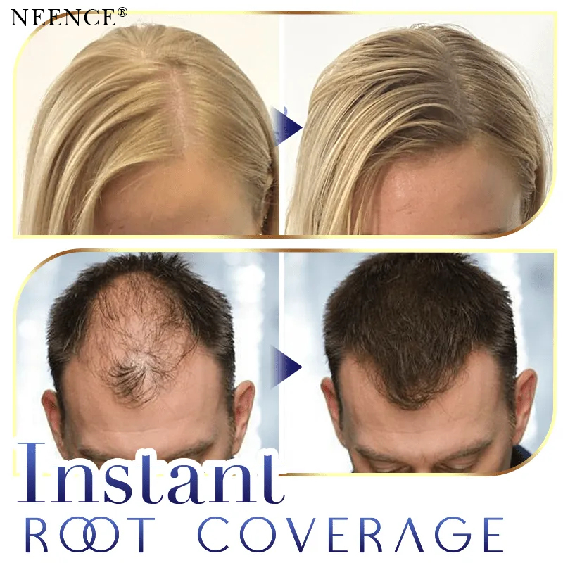 🔥2025 Hot Sale🔥 NEENCE® Premium Hairline Coverage Touch Up Powder