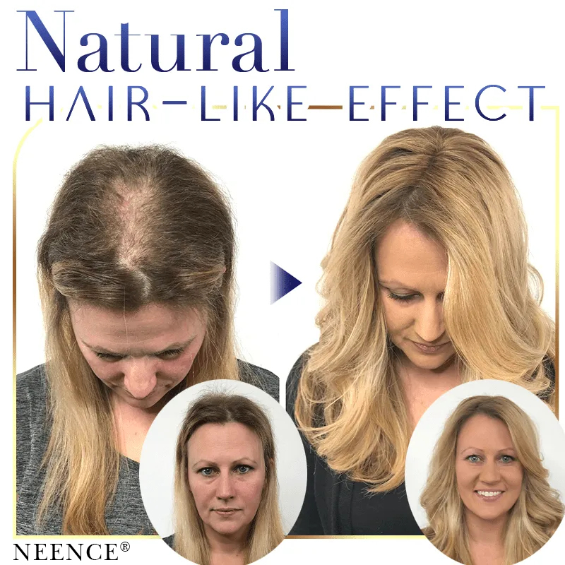 🔥2025 Hot Sale🔥 NEENCE® Premium Hairline Coverage Touch Up Powder