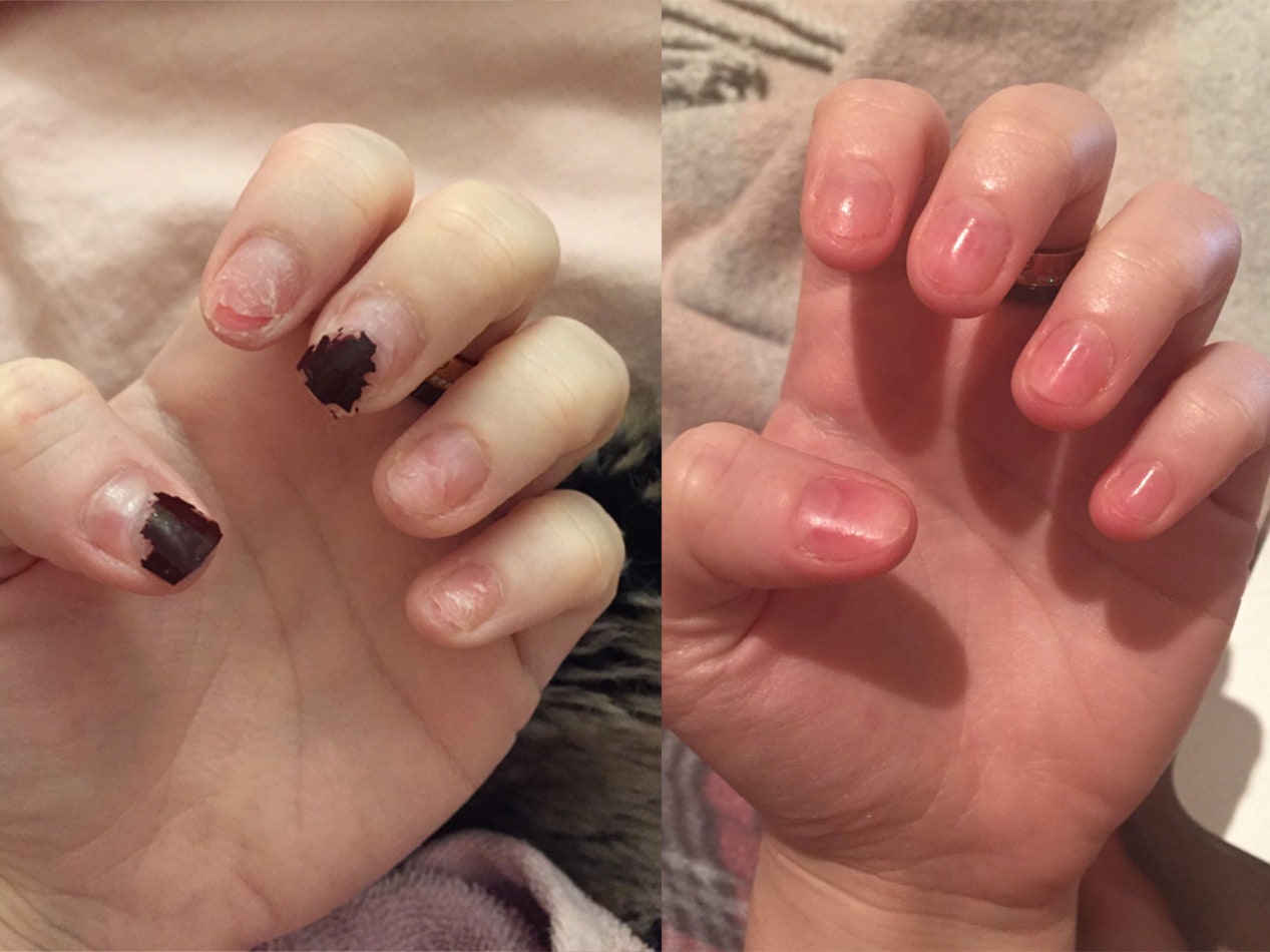 (💖Mother's Day Sale-BUY 2 GET 2 FREE)💅 Cuticle-Oil