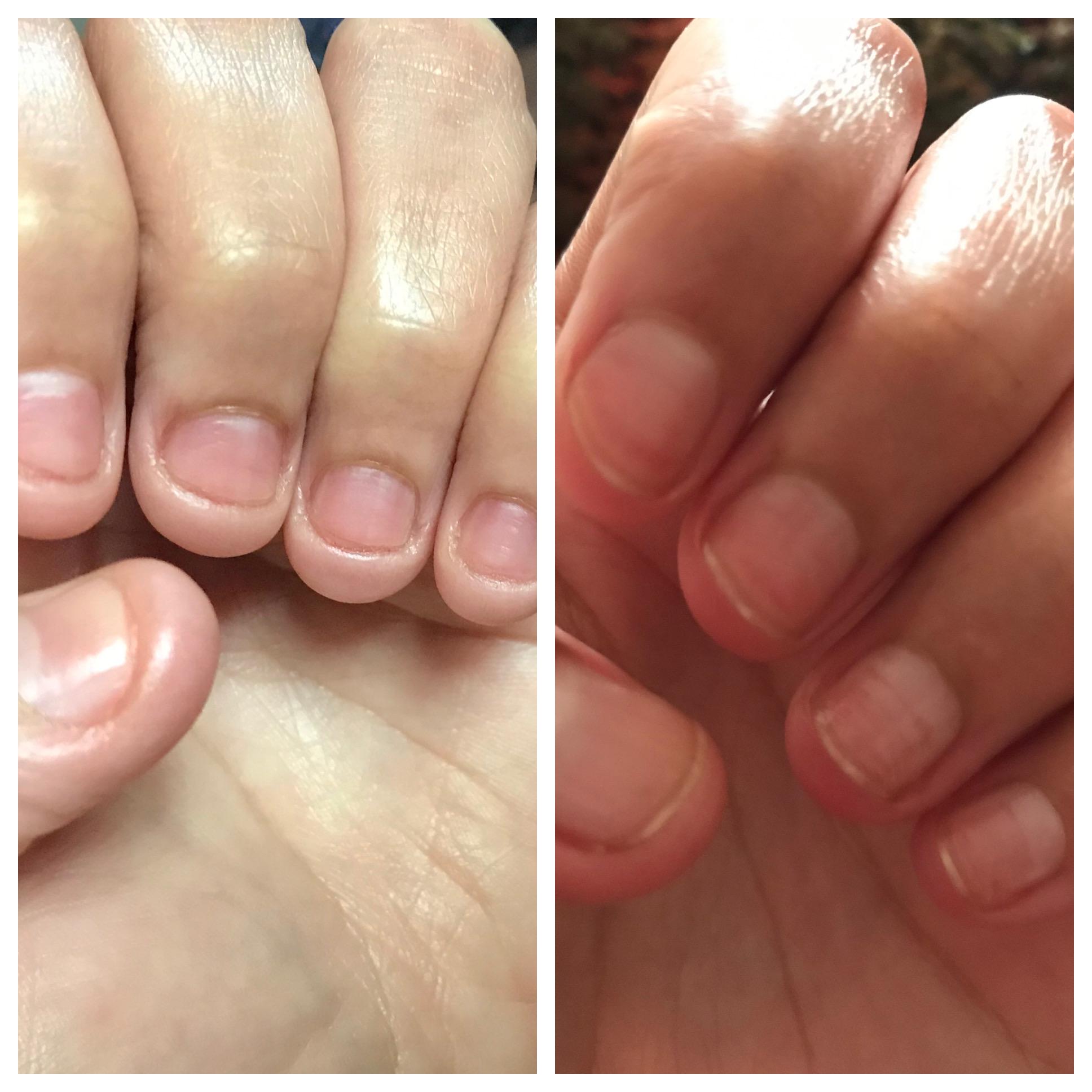 (💖Mother's Day Sale-BUY 2 GET 2 FREE)💅 Cuticle-Oil