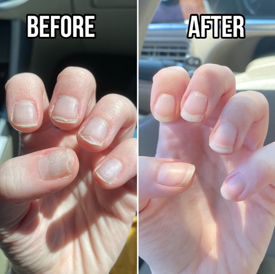 (💖Mother's Day Sale-BUY 2 GET 2 FREE)💅 Cuticle-Oil