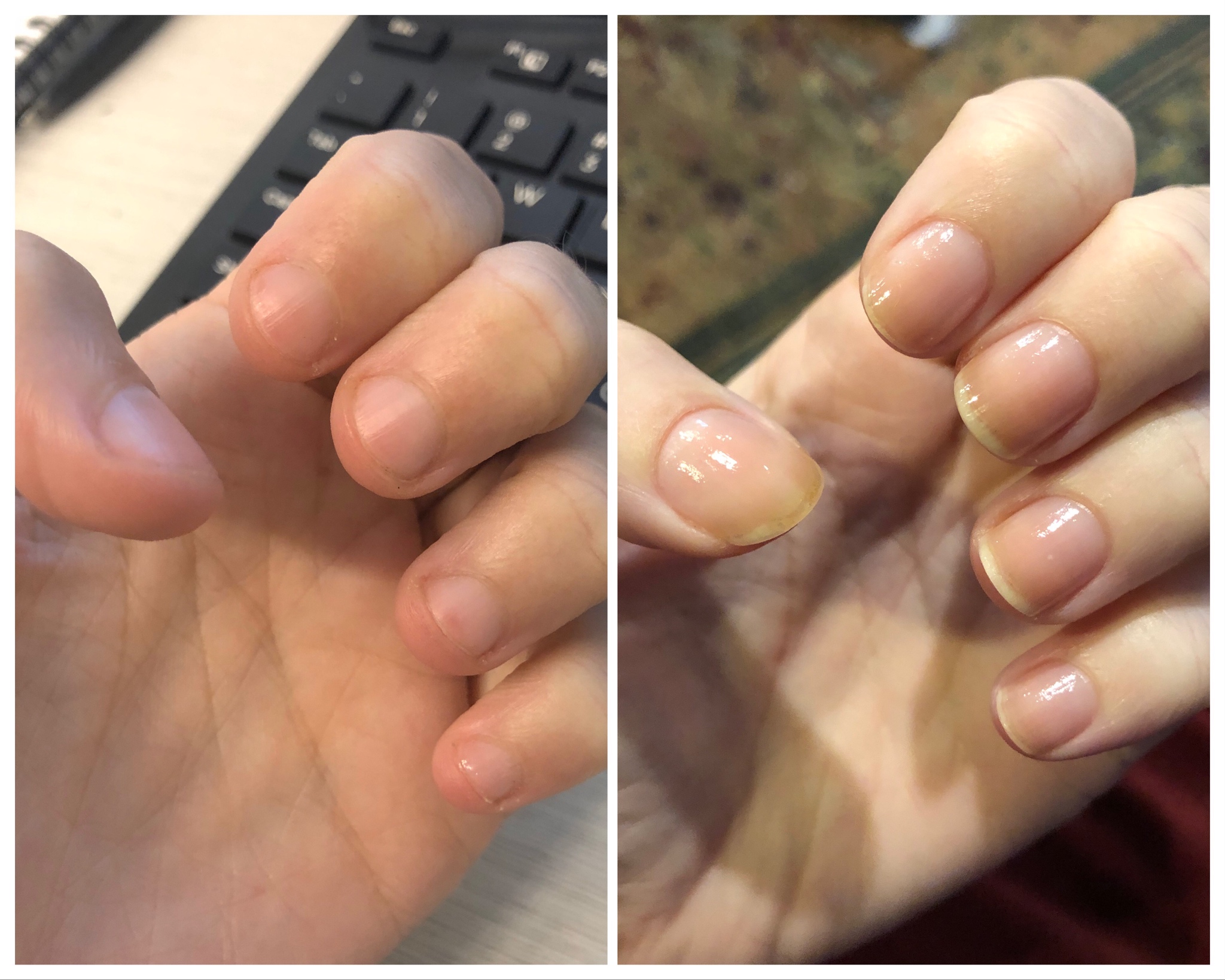 (💖Mother's Day Sale-BUY 2 GET 2 FREE)💅 Cuticle-Oil