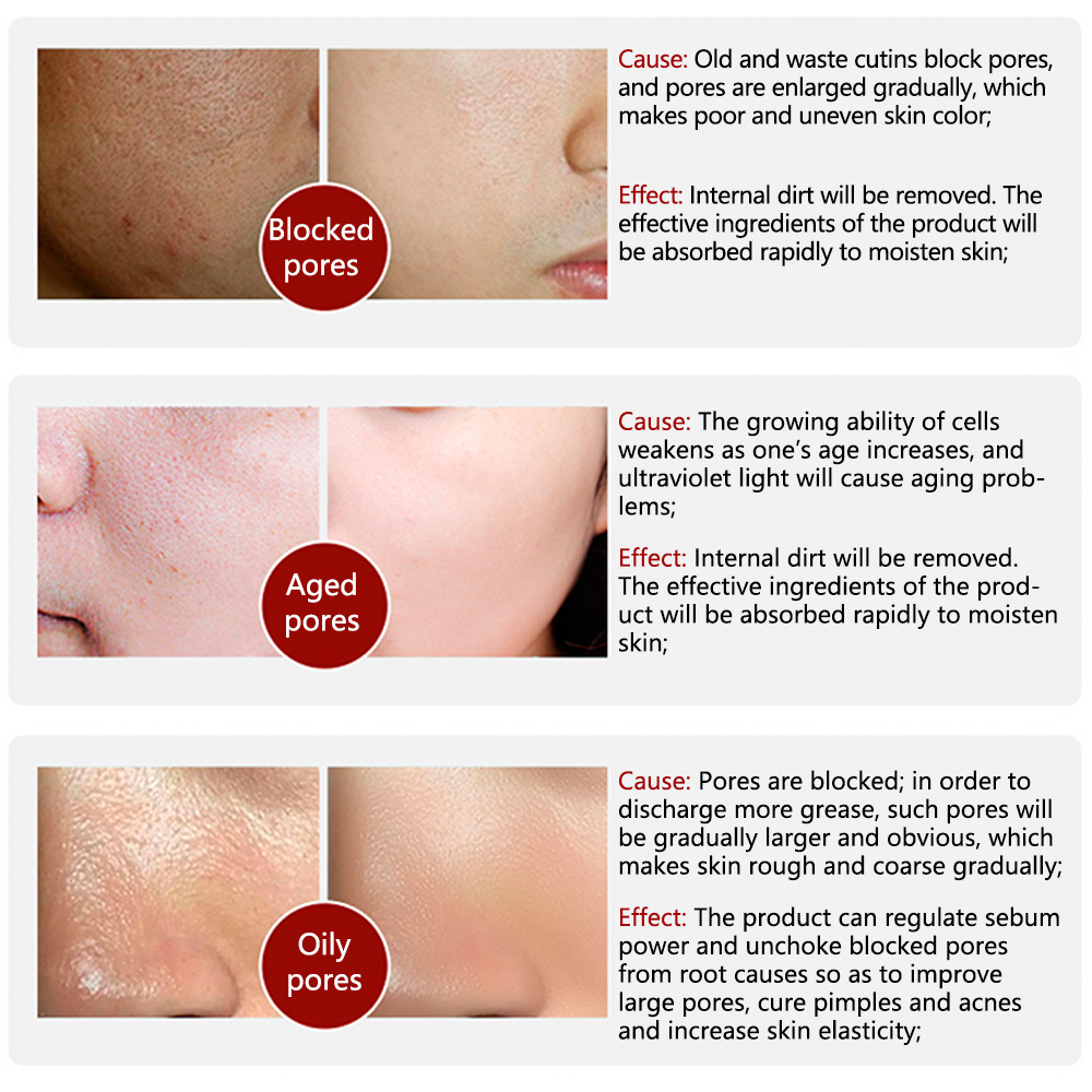 (💥Last Day Sale💥- 50% OFF) 2023 New Magical Pore Eraser Waterproof Face Primer Stick - BUY 2 GET 2 FREE