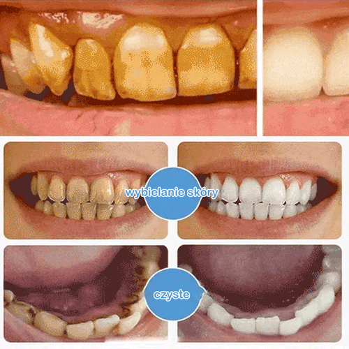 Jaysuing Wybielająca Pasta do Zębów