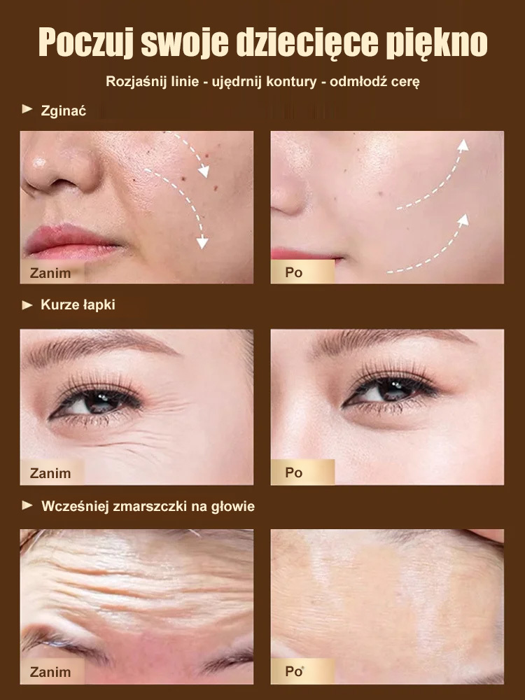 [Usuwanie zmarszczek] Dr. Yunmei Bozen serum przeciwzmarszczkowe