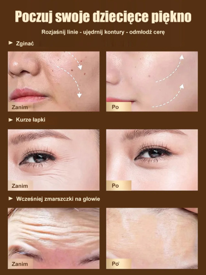 [Usuwanie zmarszczek] Dr. Yunmei Bozen serum przeciwzmarszczkowe