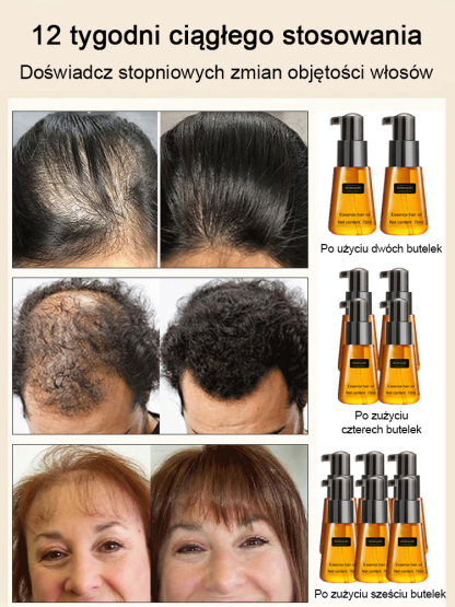 【Polecane przez lekarzy, efekty już po trzech dniach】Olejek do włosów przeciw wypadaniu i wspomagający wzrost