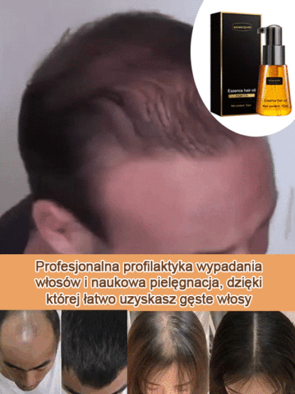【Polecane przez lekarzy, efekty już po trzech dniach】Olejek do włosów przeciw wypadaniu i wspomagający wzrost
