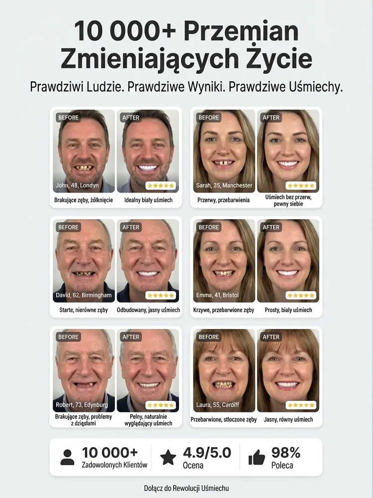 【Bestseller w USA】Zaawansowany medyczny zestaw protez dentystycznych