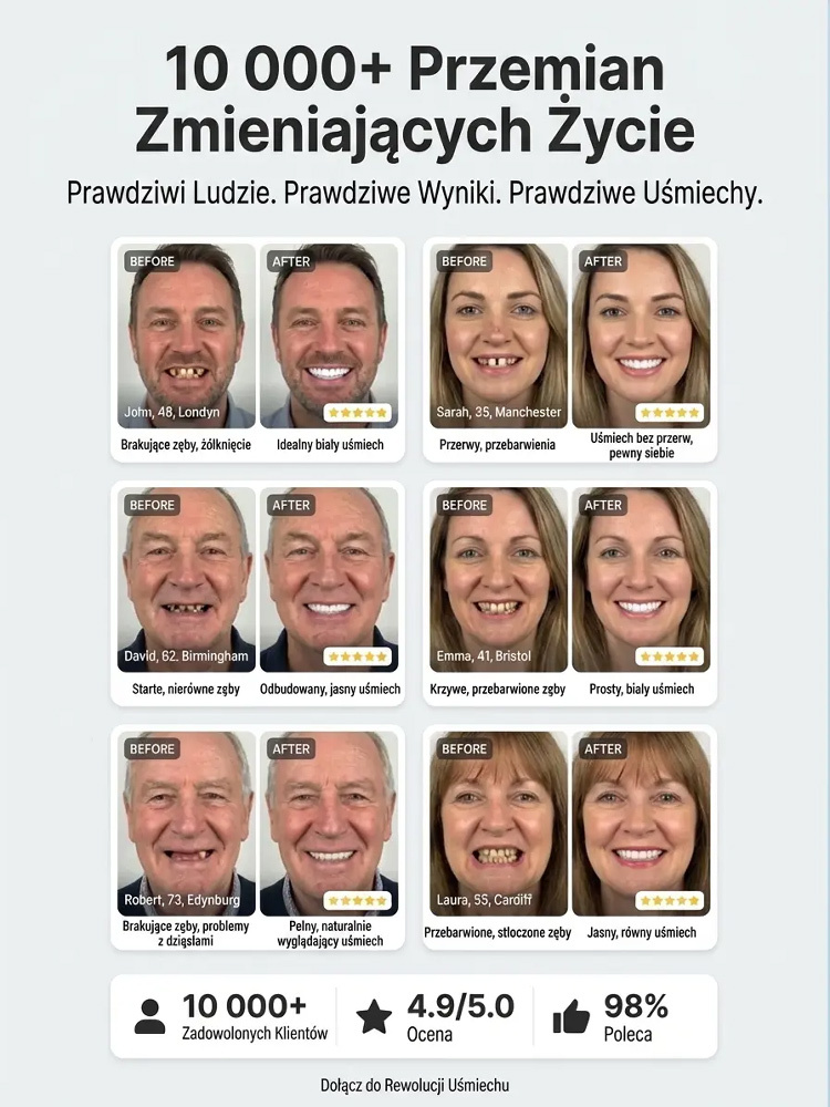 【Bestseller w USA】Zaawansowany medyczny zestaw protez dentystycznych