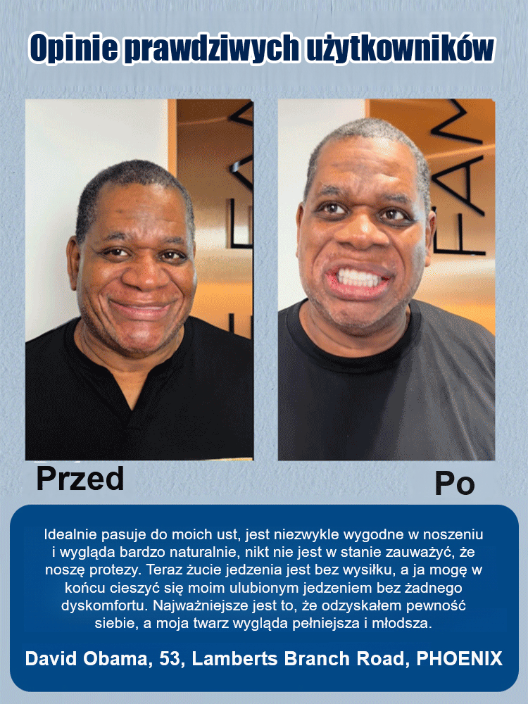 DIYCOS sztuczne zęby do charakteryzacji scenicznej