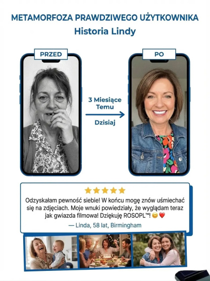 【Bestseller w USA】Zaawansowany medyczny zestaw protez dentystycznych