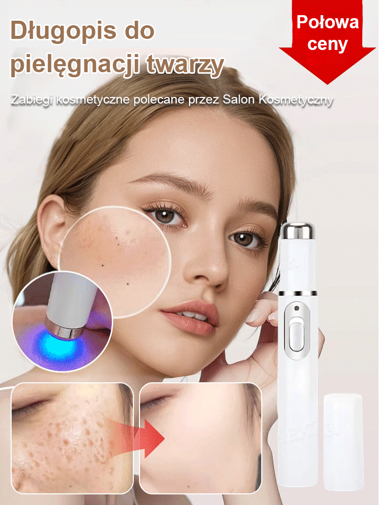 Laserowe bezbolesne pióro do usuwania brodawek