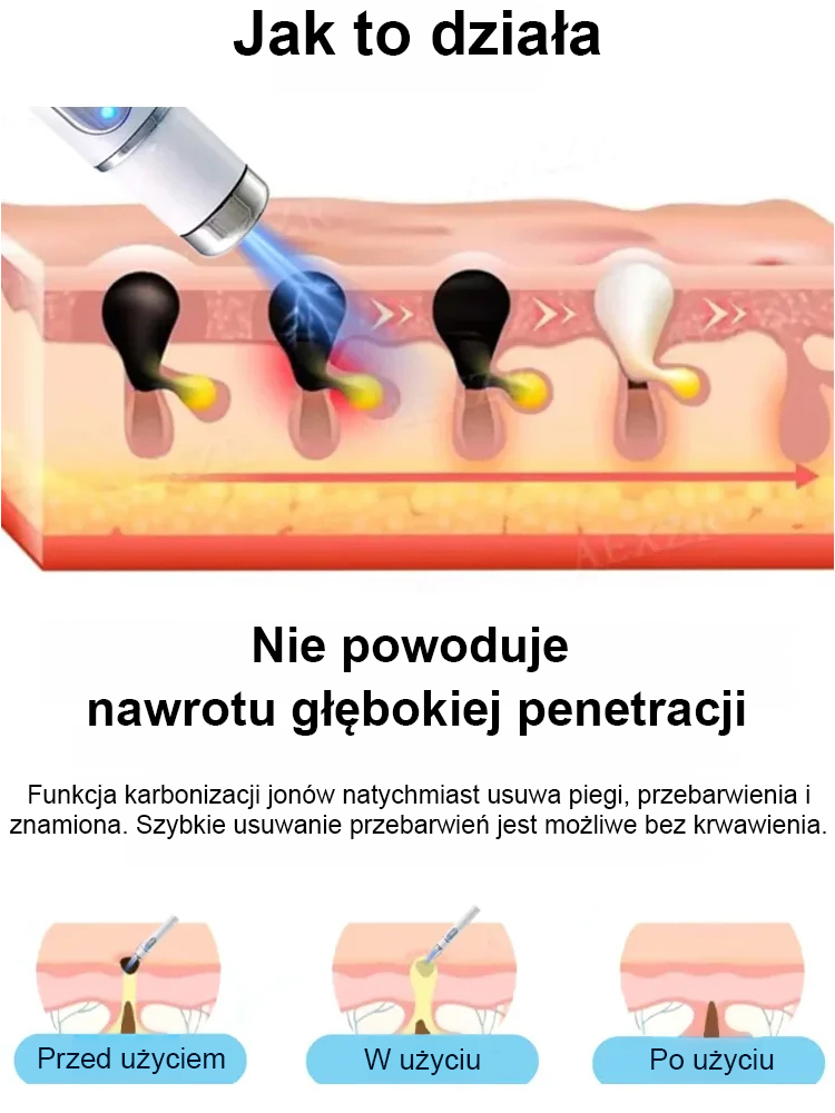Laserowe bezbolesne pióro do usuwania brodawek