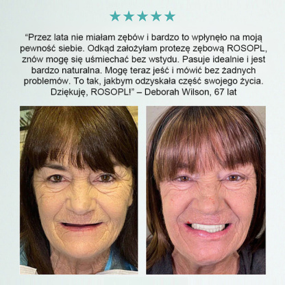 Protezy zębowe ROSOPL | FDA | Naturalny wygląd | DOSTAWA ZA POBRANIEM