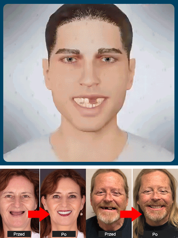 Pewność siebie podczas żucia, więcej bez obaw o luźne protezy! 🦷 Amerykański zestaw udoskonalonych protez 🔥 Odzyskaj młodzieńczą siłę gryzienia