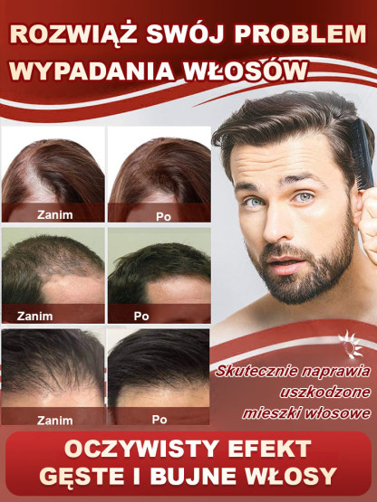 Czerwony wielofunkcyjny grzebień do masażu i wzrostu włosów