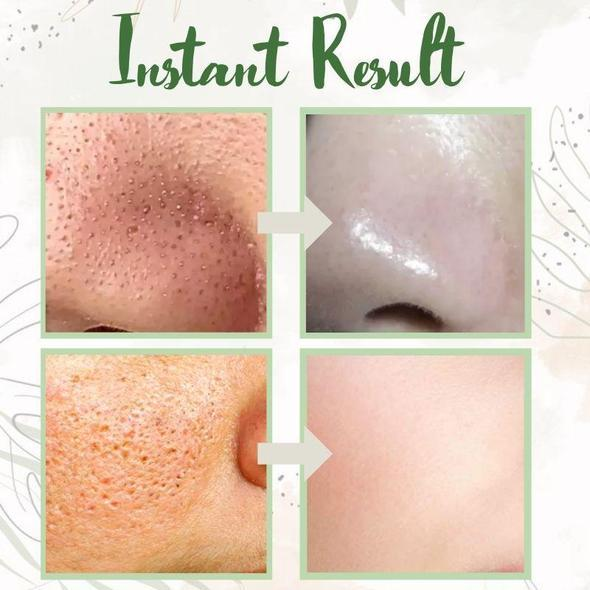 🔥Year-end special 50% off🔥Hot Sale - EELHOE™ Green Tea Deep Cleanse Mask