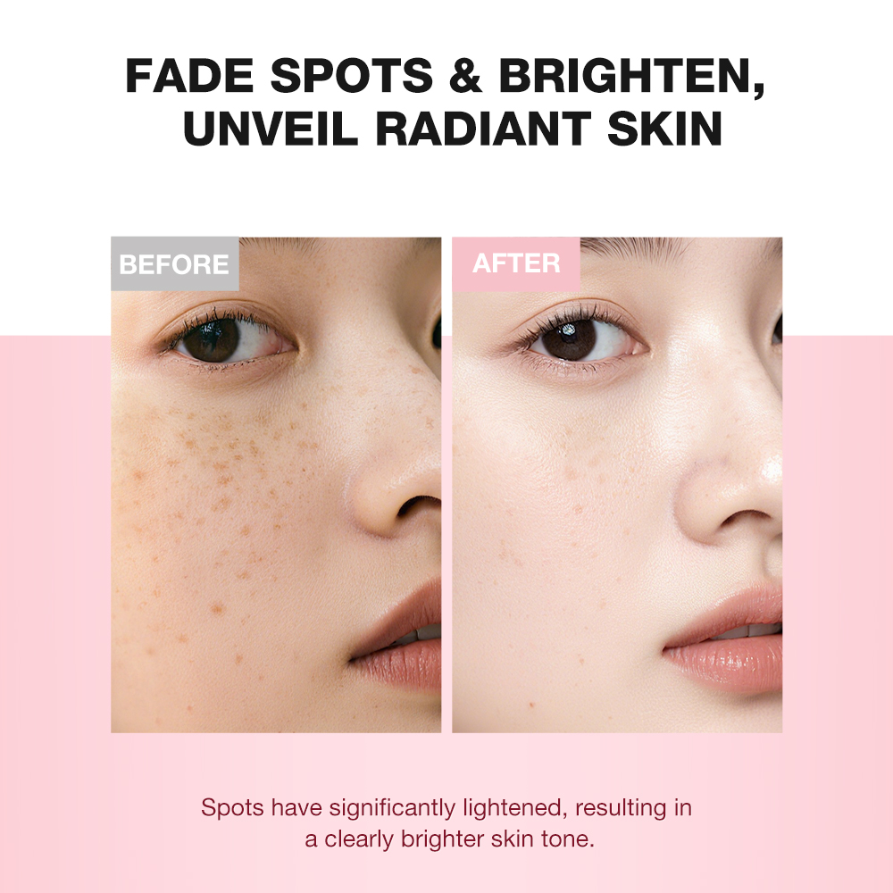 Whitening and moisturizing essence-SKINEVER PH