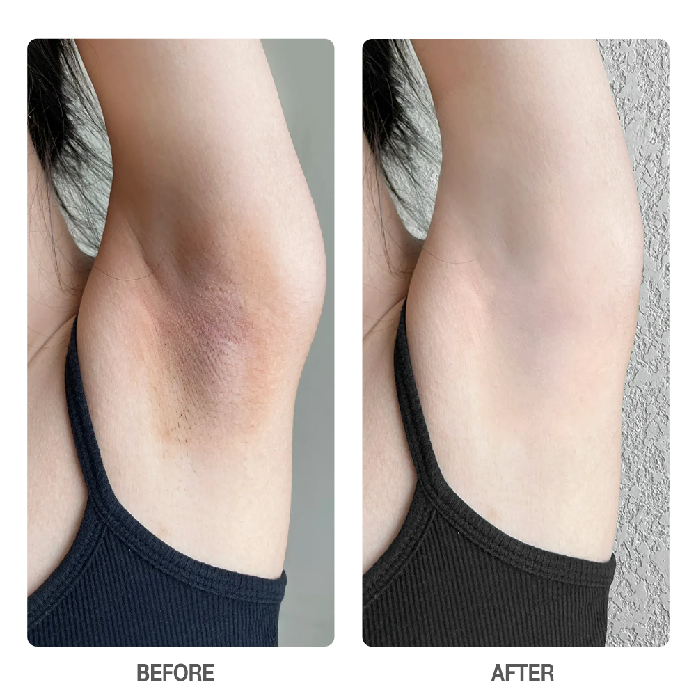 Witch Hazel Niacinamide Deodorant  Brightening Underarm Serum-SKINEVER