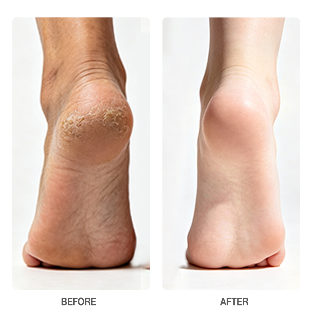 Aloe Vera Salicylic Acid Peeling Foot Mask