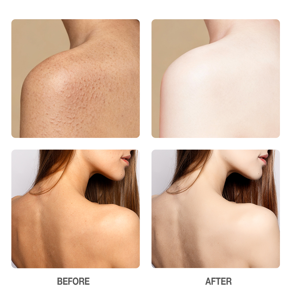 Amino Acid Brightening Fragrance Soap-SKINEVER