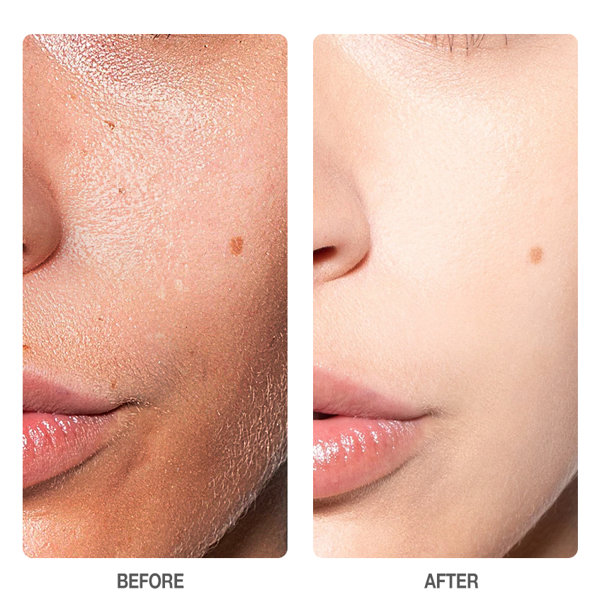 Salicylic Acid Refreshing Scrub Cleanser-SKINEVER