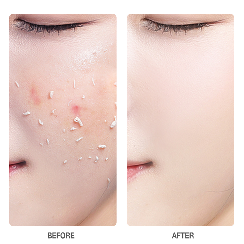 3% Niacinamide Exfoliating Whitening Gel-SKINEVER