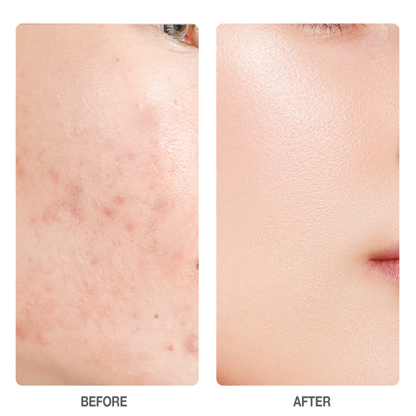 Centella Skin Soothing Masque-SKINEVER